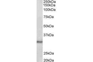 Western Blotting (WB) image for anti-CTD (Carboxy-terminal Domain, RNA Polymerase II, Polypeptide A) Small Phosphatase 1 (CTDSP1) (Internal Region) antibody (ABIN2465010)