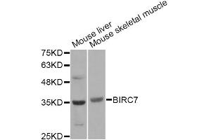 Western blot analysis of extracts of various cell lines, using BIRC7 Antibody. (BIRC7 anticorps)