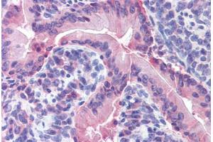 Mouse small intestine: Formalin-Fixed, Paraffin-Embedded (FFPE) (IDO1 anticorps  (AA 129-141))