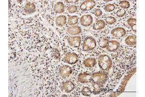 Immunoperoxidase of purified MaxPab antibody to ETHE1 on formalin-fixed paraffin-embedded human small Intestine.