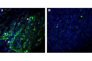 anti-Chemokine (C-C Motif) Receptor 7 (CCR7) (AA 26-40), (Extracellular) antibody