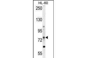 ABCD1 Antibody (Center) (ABIN654412 and ABIN2844150) western blot analysis in HL-60 cell line lysates (35 μg/lane). (ABCD1 anticorps  (AA 257-285))