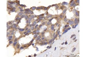 IHC analysis of DLST using anti-DLST antibody (ABIN7599412). (DLST anticorps  (AA 1-453))