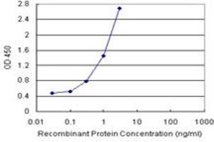 FABP1 (Human) Matched Antibody Pair