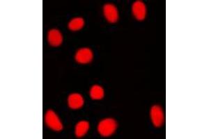 Immunofluorescent analysis of BRF1 staining in NIH3T3 cells. (BRF1 anticorps  (Center))