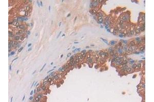 Detection of PAP in Human Prostate Tissue using Polyclonal Antibody to Prostatic Acid Phosphatase (PAP) (ACPP anticorps  (AA 217-386))