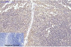 Immunohistochemical analysis of paraffin-embedded human tonsil tissue. (Caspase 8 anticorps)
