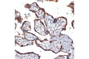 Immunohistochemistry of paraffin-embedded human placenta using TMEFF2 Rabbit mAb (ABIN1682727, ABIN3018560, ABIN3018561 and ABIN7101627) at dilution of 1:100 (40x lens).