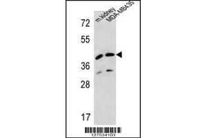 Western blot analysis in MDA-MB435 cell line and mouse kidney tissue lysates (35ug/lane). (L2HGDH anticorps  (AA 132-159))
