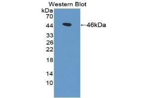 WB of Protein Standard: different control antibodies against Highly purified E.