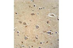 Formalin fixed and paraffin embedded human brain tissue reacted with PQLC1 Antibody  followed by peroxidase conjugation of the secondary antibody and DAB staining.