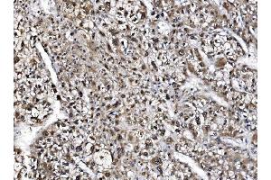 IHC analysis of NOLA1/GAR1 using anti-NOLA1/GAR1 antibody (ABIN7602076). (GAR1 anticorps  (AA 58-165))