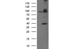 Western Blotting (WB) image for anti-Proteasome (Prosome, Macropain) 26S Subunit, Non-ATPase, 2 (PSMD2) antibody (ABIN1500482) (PSMD2 anticorps)