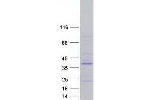 Validation with Western Blot