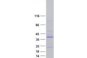 PTPN20 Protein (Transcript Variant 8) (Myc-DYKDDDDK Tag)