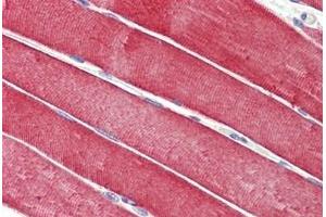 Human Skeletal Muscle: Formalin-Fixed, Paraffin-Embedded (FFPE) (DNAJC5 anticorps  (AA 177-191))
