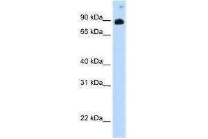 WB Suggested Anti-STAT6 Antibody Titration:  0. (STAT6 anticorps  (C-Term))