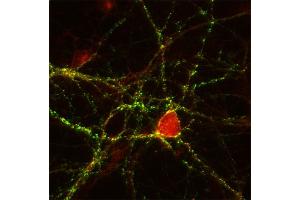 Immunocytochemistry (ICC) image for anti-Cell Adhesion Molecule 4 (CADM4) (AA 376-388) antibody (ABIN1742494)