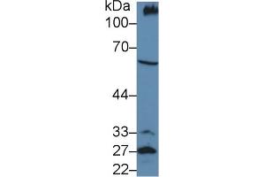 Detection of PODXL in Mouse Kidney lysate using Polyclonal Antibody to Podocalyxin (PODXL)