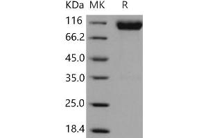 Western Blotting (WB) image for Fibroblast Growth Factor Receptor 1 (FGFR1) (Active) protein (Fc Tag) (ABIN7320382)