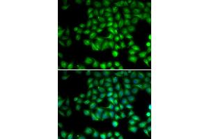 Immunofluorescence analysis of HeLa cells using TRPM2 antibody (ABIN5973615). (TRPM2 anticorps)