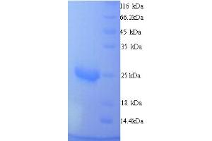 SDS-PAGE (SDS) image for Mucin 2, Oligomeric Mucus/gel-Forming (MUC2) (AA 36-240) protein (His tag) (ABIN5713680) (MUC2 Protein (AA 36-240) (His tag))