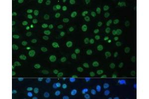 Immunofluorescence analysis of C6 cells using HNRNPD Polyclonal Antibody at dilution of 1:100.