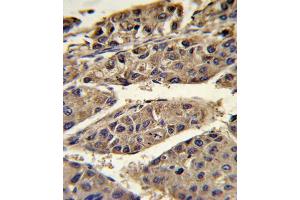Immunohistochemistry (IHC) image for anti-Haptoglobin (HP) antibody (ABIN3003969)