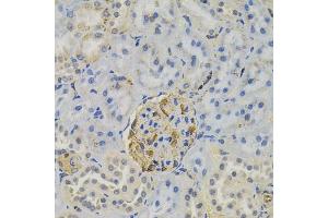 Immunohistochemistry of paraffin-embedded rat kidney using FLT3 antibody (ABIN6131275, ABIN6140693, ABIN6140696 and ABIN6223885) (40x lens). (FLT3 anticorps)