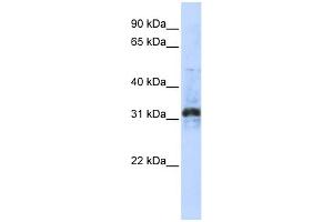 WB Suggested Anti-ZNF705D Antibody Titration:  0. (ZNF705D anticorps  (Middle Region))