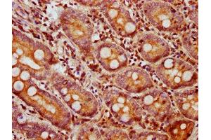 IHC image of ABIN7145684 diluted at 1:750 and staining in paraffin-embedded human small intestine tissue performed on a Leica BondTM system.