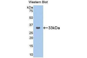 Western blot analysis of the recombinant protein. (GRAP2 anticorps  (AA 77-325))