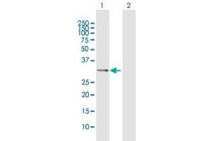 Western Blot analysis of IL1B expression in transfected 293T cell line by IL1B MaxPab polyclonal antibody.