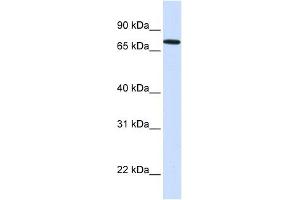 SETDB2 antibody used at 1 ug/ml to detect target protein. (SETDB2 anticorps  (N-Term))