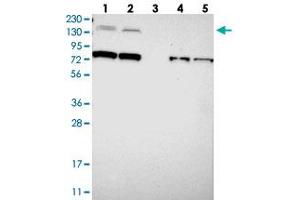Western blot analysis of Lane 1: RT-4, Lane 2: U-251 MG, Lane 3: Human Plasma, Lane 4: Liver, Lane 5: Tonsil with SORCS1 polyclonal antibody  at 1:250-1:500 dilution. (SORCS1 anticorps)