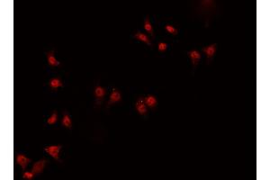 ABIN6266919 staining HeLa  cells by IF/ICC.
