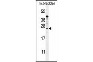Western blot analysis of KIAA1644 antibody (N-term) in mouse bladder tissue lysates (35ug/lane). (SHISAL1/KIAA1644 anticorps  (N-Term))