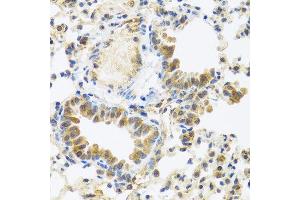 Immunohistochemistry of paraffin-embedded mouse lung using C8orf4 antibody at dilution of 1:100 (40x lens). (C8orf4 anticorps)