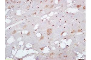 Formalin-fixed and paraffin embedded rat brain labeled with Anti-EXOC2/SEC5 Polyclonal Antibody, Unconjugated  at 1:200 followed by conjugation to the secondary antibody and DAB staining (EXOC2 anticorps  (AA 31-130))
