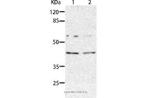 Western blot analysis of HepG2 and A549 cell, using AIMP2 Polyclonal Antibody at dilution of 1:350 (AIMP2 anticorps)