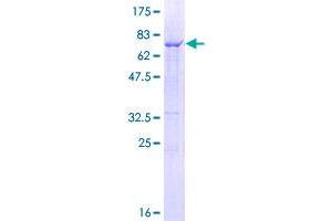 Image no. 1 for Cathepsin C (CTSC) (AA 1-463) protein (GST tag) (ABIN1350706)