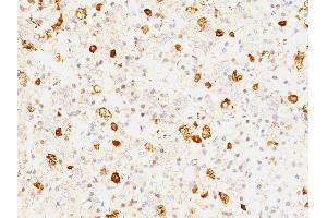 Formalin-fixed, paraffin-embedded human Pituitary stained with FSH beta Mouse Monoclonal Antibody (FSHb/1062). (FSHB anticorps)