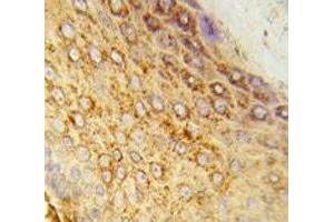 IHC analysis of FFPE human skin tissue stained with LDHA antibody