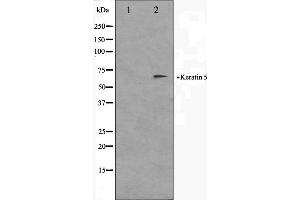 Western blot analysis on HepG2 cell lysate using Keratin 5 Antibody. (Cytokeratin 5 anticorps  (C-Term))