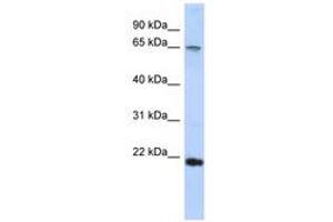 Image no. 1 for anti-DNA repair and recombination protein RAD54B (RAD54B) (C-Term) antibody (ABIN6740311) (RAD54B anticorps  (C-Term))