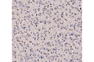IHC analysis of 5HT1B/HTR1B using anti-5HT1B/HTR1B antibody (ABIN7601425).