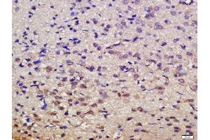 Formalin-fixed and paraffin embedded rat brain labeled with Rabbit Anti-MSK1 (Ser376) Polyclonal Antibody, Unconjugated  at 1:200 followed by conjugation to the secondary antibody and DAB staining (MSK1 anticorps  (pSer376))