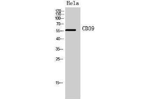 Western Blotting (WB) image for anti-Ectonucleoside Triphosphate diphosphohydrolase 1 (ENTPD1) (Internal Region) antibody (ABIN3178932) (CD39 anticorps  (Internal Region))