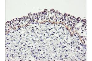 Image no. 2 for anti-Dystrobrevin, beta (DTNB) antibody (ABIN1497913)