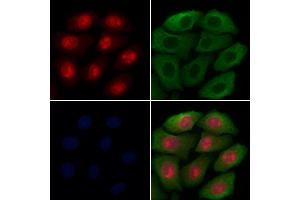 ABIN7094628 and ABIN7098678 staining Hela cells by IF/ICC. (LOXL2 anticorps  (Internal Region))
